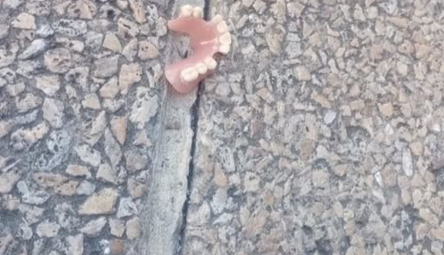 Apareció una dentadura postiza en la vereda de Pasacalle