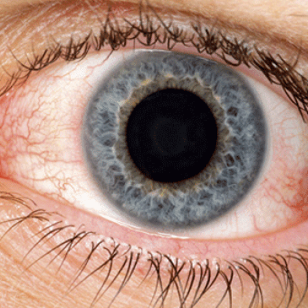 El síntoma en los ojos que revela que tienes elevado el azúcar en la sangre